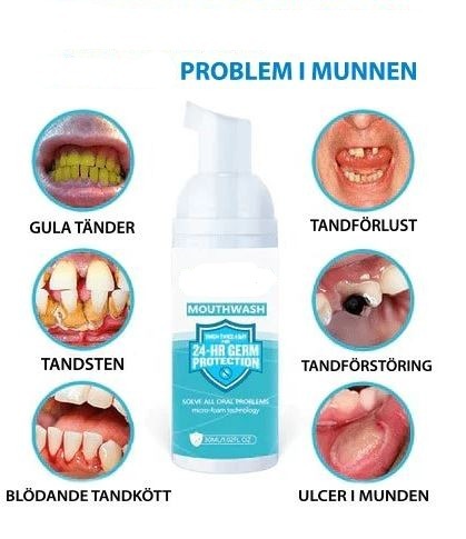 Munvård, i skumform 30ml. Tar bort fläckar och bleker tänderna samt fö